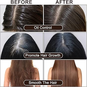 Moisture & Hair Growth Shampoo and Conditioner Set