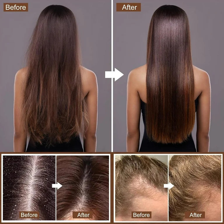 Moisture & Hair Growth Shampoo and Conditioner Set
